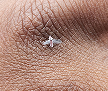 Click to enlarge woolly aphid (subfamily Eriosomatinae) 10
